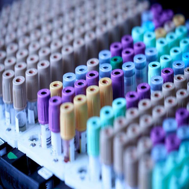 Proveedor de laboratorio en EE. UU. expuso datos médicos de 1.6 millones de personas