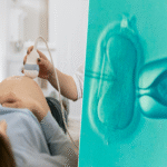 Los magnates de Silicon Valley desarrollan una nueva fijación: la optimización prenatal de sus hijos.