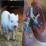 Ya existe el primer ser humano con un implante de pulmón porcino: el inicio de una revolución en el campo de los trasplantes.