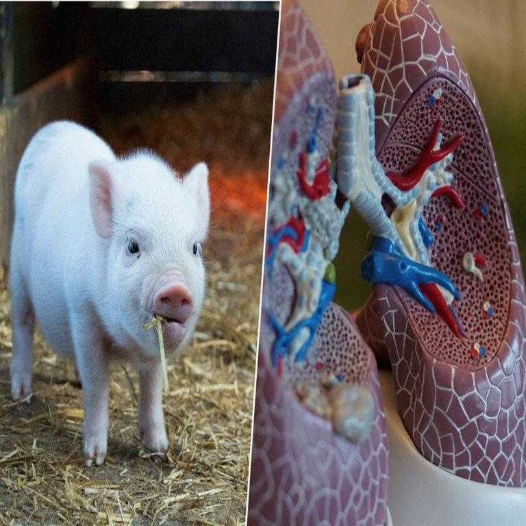 Ya existe el primer ser humano con un implante de pulmón porcino: el inicio de una revolución en el campo de los trasplantes.
