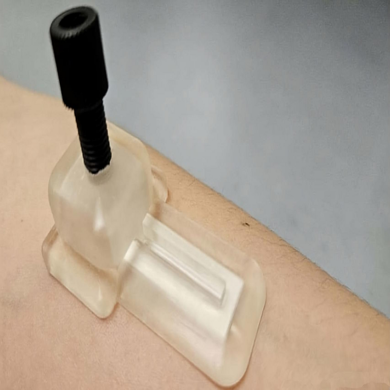 Fin de los análisis de sangre: parche para monitorización continua de la salud durante horas, sin necesidad de baterías o procedimientos invasivos.