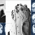 China posee una estrategia para superar a Estados Unidos y Neuralink en la competencia por los implantes de interfaz cerebro-computadora.