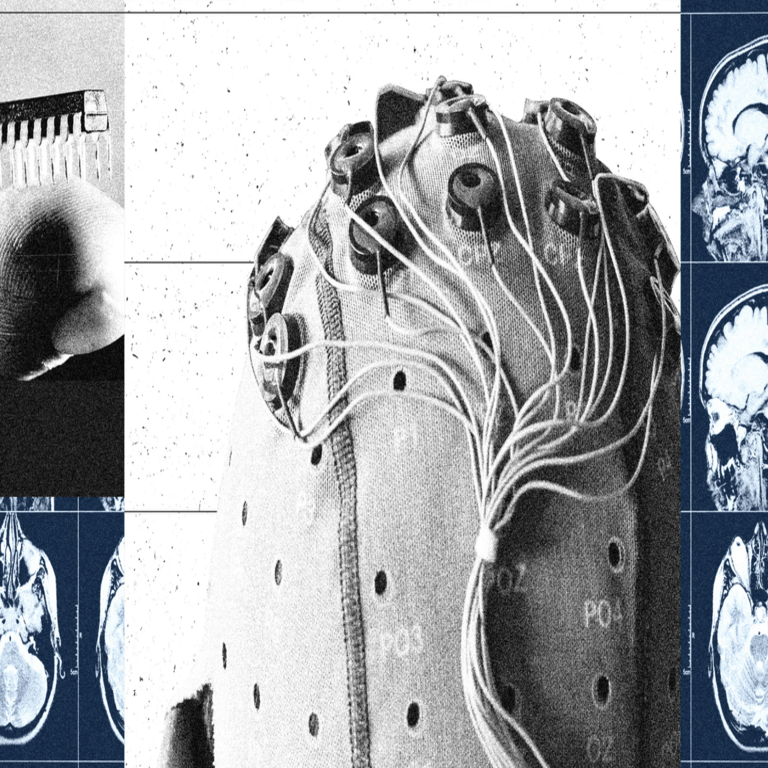China posee una estrategia para superar a Estados Unidos y Neuralink en la competencia por los implantes de interfaz cerebro-computadora.