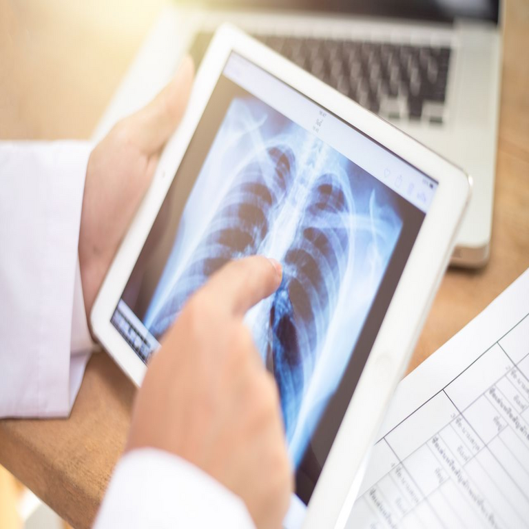 Según un estudio, las concentraciones de microplásticos en el aire que se inhalan cotidianamente superan considerablemente las estimaciones anteriores.