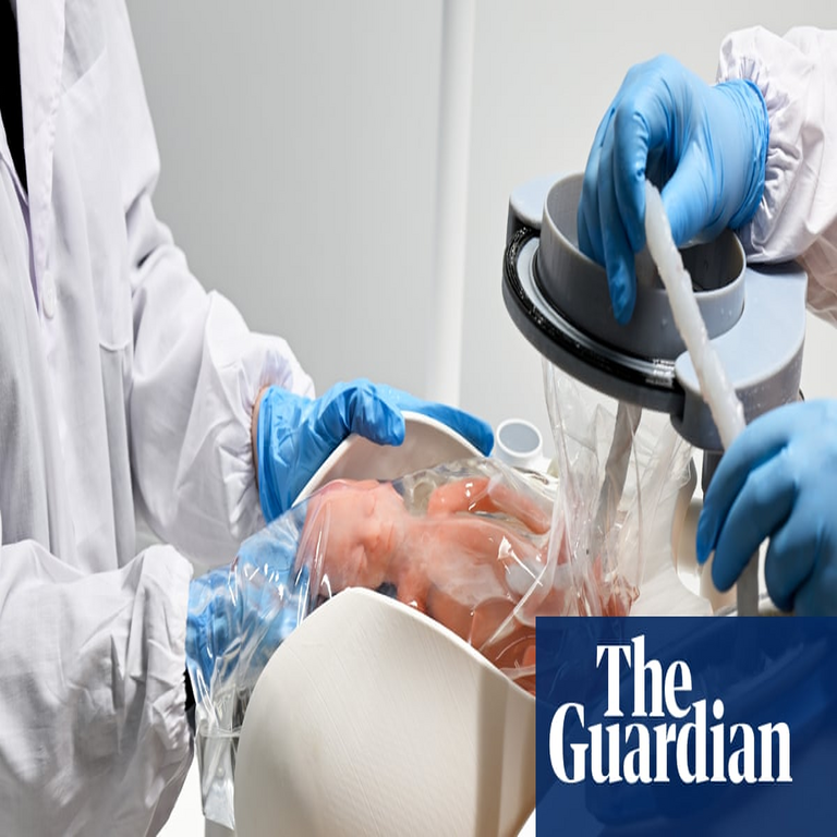 Esta máquina podría mantener vivo a un bebé fuera del útero. ¿Cómo decidirá el mundo su uso?