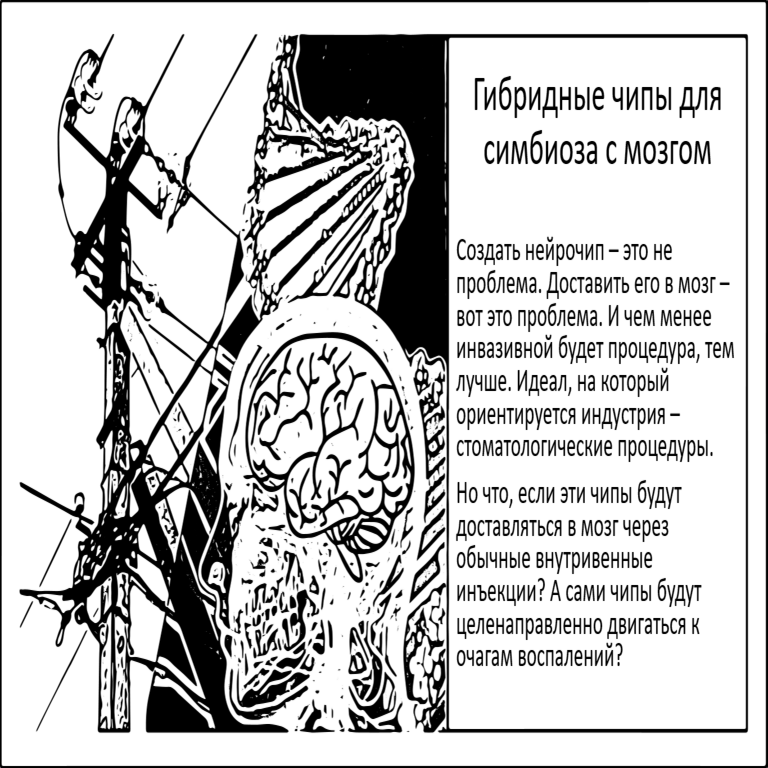 Implantes cerebrales en formato de inyecciones: Innovación desarrollada por el MIT.