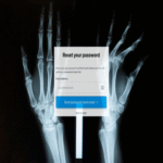 Un individuo se implantó un microchip en la mano para ejecutar ilusiones mágicas, y el procedimiento funcionó correctamente hasta que olvidó la clave de acceso.