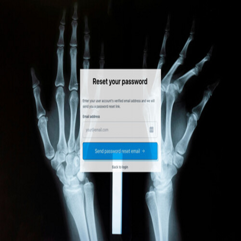 Un individuo se implantó un microchip en la mano para ejecutar ilusiones mágicas, y el procedimiento funcionó correctamente hasta que olvidó la clave de acceso.