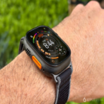 Este modelo de inteligencia artificial se compromete a identificar enfermedades de forma precoz, habiendo sido desarrollado con datos métricos de un Apple Watch recopilados durante tres millones de días.