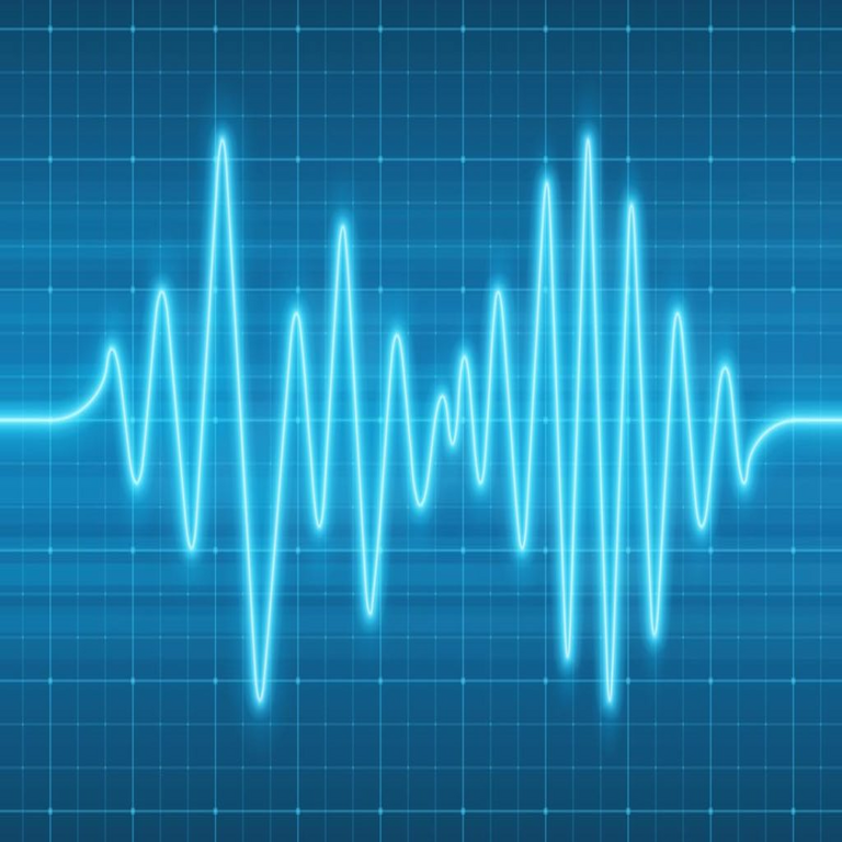 Los elevados costos del espectro están obstaculizando la inversión en Europa, según la GSMA. Los elevados costos del espectro están obstaculizando la inversión en Europa, según la GSMA.