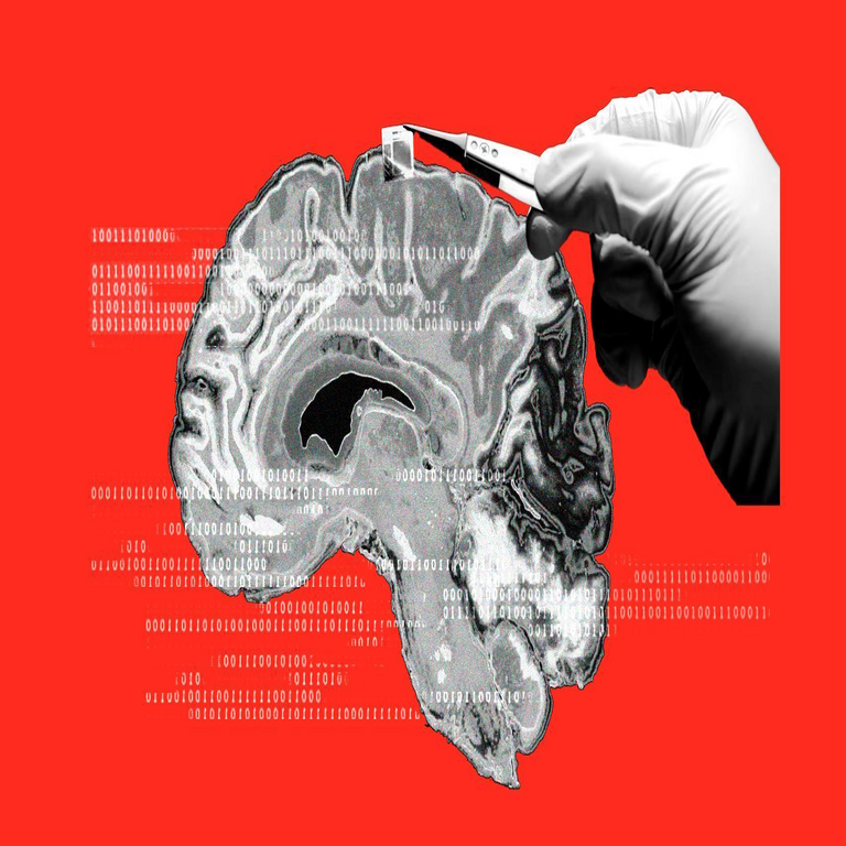 El implante ultrafino que facilitará la conexión inalámbrica entre el cerebro y la inteligencia artificial podría restaurar la visión o la audición en una persona. El implante ultrafino que facilitará la conexión inalámbrica entre el cerebro y la inteligencia artificial podría restaurar la visión o la audición en una persona.