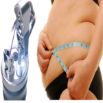 Historia del desarrollo de Apollo OverStitch: cómo una idea de ingeniería se transformó en una tecnología para el tratamiento de la obesidad Historia del desarrollo de Apollo OverStitch: cómo una idea de ingeniería se transformó en una tecnología para el tratamiento de la obesidad