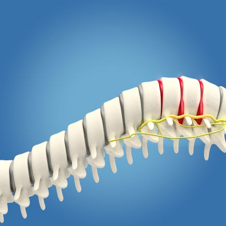 Dolor lumbar, o «Enderezar la postura de nuevo»