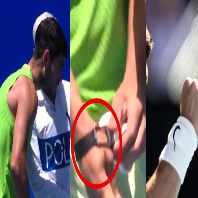El dispositivo restringido de Carlos Alcaraz: el mecanismo de Whoop y los beneficios que proporciona la pulsera excluida por el Open de Australia en el tenis