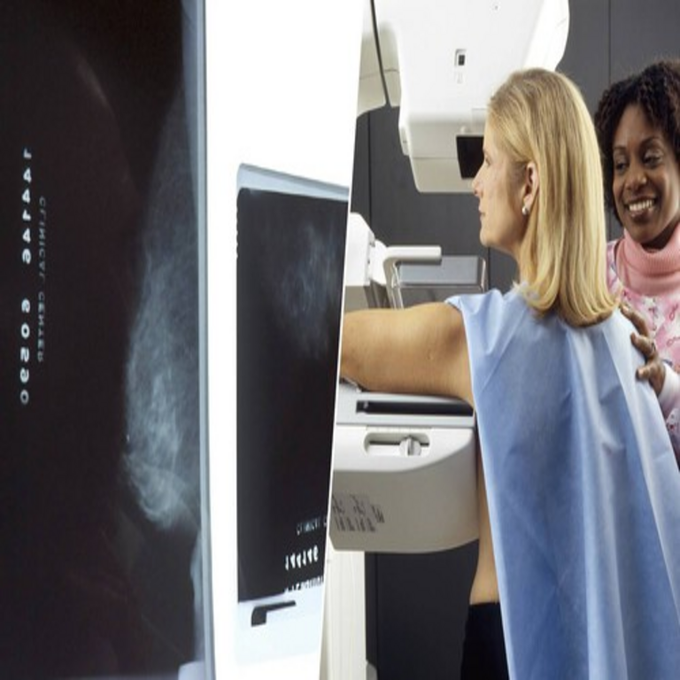 La inteligencia artificial trasciende la fase de promesa en el cáncer de mama: el ensayo clínico de mayor escala valida que incrementa la detección y disminuye la carga laboral de los radiólogos.