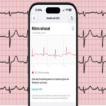 Método para exportar un electrocardiograma del Apple Watch a formato PDF, con la opción de imprimirlo para presentarlo al médico.